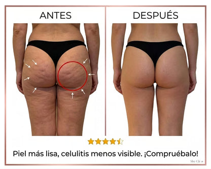 Redulitis Lift Pro - Dispositivo Anticelulítico y Reafirmante